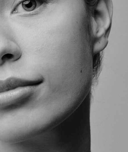acide-hyaluronique_margot-1678033796 (1)