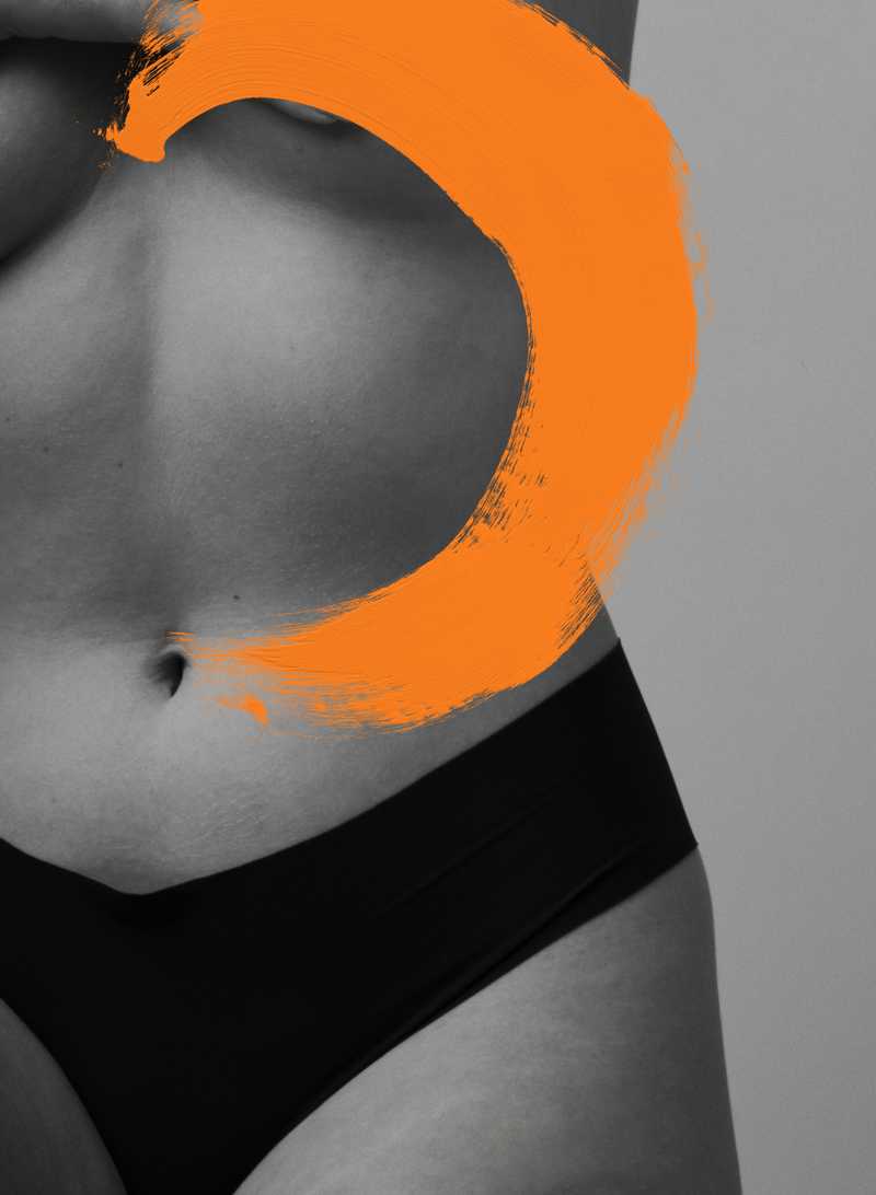 Miniabdominoplastie Lausanne