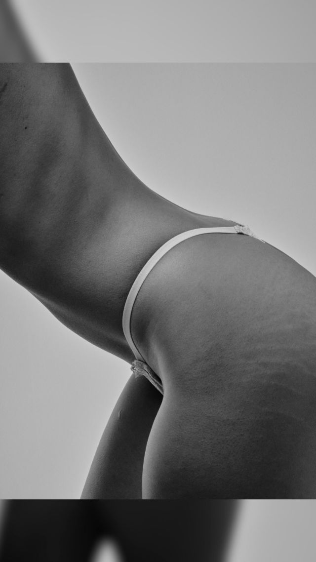 Vous souffrez de jambes douloureuses, lourdes, gonflées ?
Vous avez l’impression que la graisse reste malgré tous vos efforts ?
Il pourrait s’agir de lipœdème, une maladie encore trop peu connue, mais bien réelle.

👉 À la Clinique AMiiA, nous proposons des traitements adaptés pour soulager vos douleurs, améliorer votre qualité de vie et retrouver plus de légèreté au quotidien.

✨ Vivre sans douleur, c’est possible. Parlons-en.

📞 Contactez-nous pour un diagnostic personnalisé

💻 www.amiiaclinique.ch 
📞 021 577 63 53 
💌 info@amiiaclinique.ch

#lipoedème #amiiaclinique #lausanne